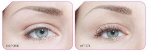 wimperlift